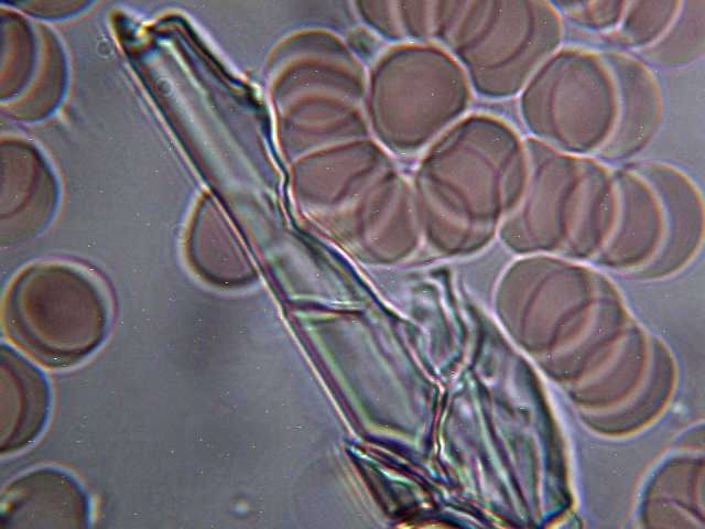 Los glóbulos rojos o hematíes y el colesterol son valores típicos de los análisis de sangre.